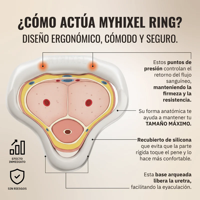 Diagrama anatómico — cómo actúa el MYHIXEL Ring